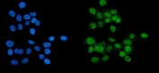 Poly (ADP-ribose) polymerase 1 Antibody IF. Immunofluorescent staining of FFPE human A431 cells with Poly (ADP-ribose) polymerase 1 antibody (green) and DAPI nuclear stain (blue). HIER: steam section in pH6 citrate buffer for 20 min.
