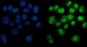 PARP1 Antibody A431 Cell IF. Immunofluorescent staining of FFPE human A431 cells with PARP1 antibody (green) and DAPI nuclear stain (blue). HIER: steam section in pH6 citrate buffer for 20 min.