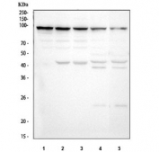 Argonaute 3 Antibody Multi-Sample WB. Western blot analysis of human and rodent lysates using Argonaute 3 antibody detecting AGO3. Lane 1: human K562, Lane 2: human PC-3, Lane 3: human Caco-2, Lane 4: rat brain, Lane 5: mouse brain. A prominent band is observed at approximately 95-100 kDa across samples, consistent with the predicted molecular weight of AGO3. Additional lower molecular weight bands may represent degradation or non-specific signal. The primary banding pattern supports AGO3 expression as a component of the RISC complex involved in RNA silencing and post-transcriptional gene regulation.