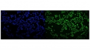 Immunofluorescent staining of FFPE human MCF7 cells with hnRNP H3 antibody (green) and DAPI nuclear stain (blue). HIER: steam section in pH6 citrate buffer for 20 min.