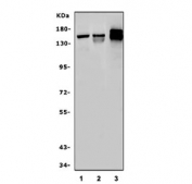 Western blot testing of 1) rat brain, 2) mouse brain and 3) mouse Neuro-2a lysate with NCAM1 antibody. Predicted molecular weight: ~110 kDa (soluble fragment), ~120/125 kDa (GPI-anchored), 140/180 kDa (transmembrane isoforms).