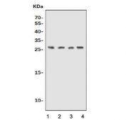 UPK1B Antibody for WB. Western blot analysis of Uroplakin 1B / UPK1B antibody in lysates from 1) human K562 cells, 2) human SK-OV-3 cells, 3) rat stomach tissue, and 4) mouse stomach tissue using UPK1B Antibody / Epithelial Barrier Protein Antibody. A band is detected at approximately 25â30 kDa, consistent with the predicted molecular weight of Uroplakin 1B / UPK1B. The observed band aligns with expression of this epithelial barrier-associated protein, reflecting its role in maintaining urothelial integrity.