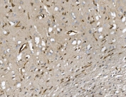 CD34 Antibody Rat Brain IHC. Immunohistochemistry analysis of CD34 expression in FFPE rat brain demonstrates membranous HRP-DAB brown staining in vascular endothelial cells highlighting fine capillary networks and small vessel structures throughout neural tissue, while neuronal and glial cells remain largely negative. The staining pattern supports visualization of cerebral microvasculature and endothelial cell distribution in rat brain. HIER: boil tissue sections in pH8 EDTA for 20 min and allow to cool before testing.
