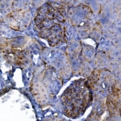 CD34 Antibody Rat Kidney IHC. Immunohistochemistry analysis of CD34 expression in FFPE rat kidney demonstrates membranous HRP-DAB brown staining in vascular endothelial cells within glomerular capillary tufts and interstitial vessels, highlighting fine microvascular networks, while renal tubular epithelial cells remain largely negative. The staining pattern supports visualization of renal vascular architecture and endothelial cell localization in rat kidney. HIER: boil tissue sections in pH8 EDTA for 20 min and allow to cool before testing.