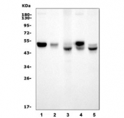 Interferon regulatory factor 3 Antibody Mouse Rat WB. Western blot testing of 1) rat brain, 2) rat C6, 3) mouse lung, 4) mouse brain and 5) mouse NIH 3T3 cell lysate with Interferon regulatory factor 3 antibody. Predicted molecular weight ~47 kDa.