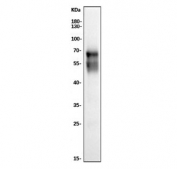 CD5 Antibody for WB. Western blot analysis of CD5 antibody (clone 11B4) in rat thymus lysate using a rat reactive immune marker antibody. A band is detected at approximately 55-67 kDa, consistent with the predicted molecular weight of CD5, with size variation reflecting known glycosylation of this membrane glycoprotein. The strong signal observed in thymus tissue aligns with the high enrichment of CD5 in developing and mature T lymphocytes within this organ.