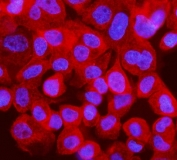 Interferon regulatory factor 3 Antibody A431 IF. Immunofluorescent staining of FFPE human A431 cells with Interferon regulatory factor 3 antibody (red) and DAPI nuclear stain (blue). HIER: steam section in pH6 citrate buffer for 20 min.