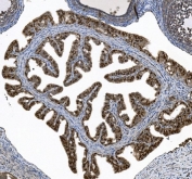 Immunohistochemistry of HFH-4/FOXJ1 in rat ovary tissue. HFH-4 antibody staining is observed predominantly in ovarian epithelial cells within a paraffin-embedded rat ovary section, consistent with nuclear localization of FOXJ1 in ciliated or ciliogenesis-associated epithelial cells. Heat mediated antigen retrieval was performed using EDTA buffer (pH 8.0). Sections were blocked with 10% goat serum and incubated with rabbit anti-HFH-4/FOXJ1 antibody at 2 ug/ml overnight at 4C, followed by biotinylated goat anti-rabbit IgG secondary antibody. Signal was developed using streptavidin-biotin complex with DAB chromogen, and nuclei were counterstained with hematoxylin.