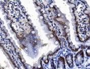 Pycard Antibody Mouse Intestine IHC. Immunohistochemical staining of FFPE mouse intestine tissue using PYCARD Antibody / Inflammasome Adaptor Protein Antibody. PYCARD expression is detected predominantly within the cytoplasm of intestinal epithelial cells, consistent with its role as a central adaptor protein in inflammasome assembly, innate immune signaling, and regulation of mucosal inflammatory responses. Heat-induced epitope retrieval was performed by boiling tissue sections in pH 8 EDTA buffer for 20 minutes and allowing them to cool prior to immunostaining.