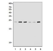 Pycard Antibody WB. Western blot analysis of 1) rat lung, 2) rat spleen, 3) rat thymus, 4) mouse lung, 5) mouse spleen, and 6) mouse thymus tissue lysates using PYCARD Antibody / Inflammasome Adaptor Protein Antibody. A distinct immunoreactive band is detected at approximately 22 kDa across all tissue lysates, consistent with the predicted molecular weight of PYCARD (ASC), supporting specific detection of the endogenous inflammasome adaptor protein in both rat and mouse tissues.