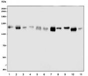 NOTCH1 Antibody Multi-Species WB. Western blot analysis of human HEK293, K562, U-2 OS, Jurkat, HeLa, ThP-1, and Caco-2 cell lysates, together with rat brain, rat PC-12, mouse lung, and mouse brain tissue lysates using NOTCH1 antibody demonstrates a prominent band at approximately 120 kDa across multiple human, rat, and mouse samples. This band is consistent with the transmembrane fragment of NOTCH1 generated during normal receptor processing and activation. NOTCH1 is a transmembrane receptor that functions as a central regulator of the Notch signaling pathway, controlling cell fate determination, differentiation, and developmental signaling through cell-to-cell communication. The broad expression observed across diverse cell lines and tissues is consistent with the widespread biologic importance of NOTCH1 in tissue homeostasis, developmental regulation, and signal transduction. Expected molecular weights: approximately 270 kDa for full-length NOTCH1 and 120 kDa for the transmembrane fragment.