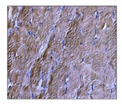 DYSF Antibody Skeletal Muscle IHC. Immunohistochemistry staining of FFPE human skeletal muscle tissue using DYSF Antibody demonstrates widespread cytoplasmic and sarcolemmal-associated HRP-DAB brown staining throughout skeletal muscle fibers. The staining pattern is consistent with expression of Dysferlin / DYSF, a ferlin family membrane repair protein that supports calcium-dependent sarcolemmal maintenance and recovery following muscle fiber injury. Signal is distributed along elongated myofibers with membranous accentuation, reflecting the established role of Dysferlin in membrane remodeling and preservation of muscle integrity in mechanically active tissues. HIER: boil tissue sections in pH8 EDTA for 20 min and allow to cool before testing.