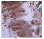 DYSF Antibody Skeletal Muscle Tissue IHC. Immunohistochemistry staining of FFPE mouse skeletal muscle tissue using DYSF Antibody demonstrates strong cytoplasmic and sarcolemmal-associated HRP-DAB brown staining throughout skeletal muscle fibers. The staining pattern is consistent with expression of Dysferlin / DYSF, a membrane repair protein that supports calcium-dependent sarcolemmal maintenance and recovery following contraction-induced membrane injury. Prominent staining within elongated myofibers highlights the established role of Dysferlin in membrane remodeling, muscle fiber stability, and preservation of skeletal muscle integrity. HIER: boil tissue sections in pH8 EDTA for 20 min and allow to cool before testing.