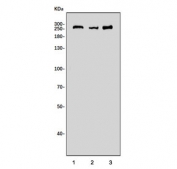 DYSF Antibody Multi-Species Heart WB. Western blot analysis of Lane 1: human PC-3 cell lysate, Lane 2: rat heart lysate, and Lane 3: mouse heart lysate using DYSF Antibody / Dysferlin Membrane Repair Protein Antibody. A band is detected at approximately 250-260 kDa in all three samples, corresponding to Dysferlin / DYSF. The observed molecular weight is modestly higher than the predicted molecular weight of approximately 237 kDa, which can occur with large membrane-associated proteins. Dysferlin is a ferlin family membrane repair protein that mediates calcium-dependent sarcolemmal restoration and maintenance of muscle cell integrity. Detection in rat and mouse heart lysates is consistent with the established expression of Dysferlin in contractile tissues that undergo continual mechanical stress and membrane remodeling.