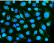 Dysferlin Antibody IF/ICC. Immunofluorescence analysis of SiHa cells using Dysferlin Antibody demonstrates distinct cytoplasmic and membranous green fluorescence consistent with the established localization of Dysferlin (DYSF), a membrane-associated protein involved in sarcolemmal repair, vesicle trafficking, and membrane fusion processes. Signal is distributed throughout the cytoplasm with enrichment along cellular membranes, while nuclei are counterstained with DAPI (blue). The observed staining pattern supports studies of Dysferlin (DYSF) function, skeletal muscle membrane repair, sarcolemmal integrity, vesicle trafficking, muscular dystrophy research, and muscle fiber regeneration pathways. Enzyme antigen retrieval was performed for 15 minutes prior to staining. Target protein is visualized in green and nuclei are shown in blue.