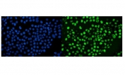 Ki-67 Antibody for IF Staining / Ki67 Staining Antibody (clone 5E12). Immunofluorescence analysis of FFPE human A431 cells using Ki-67 antibody for IF staining (clone 5E12). Strong nuclear fluorescence (green) identifies proliferating cells expressing Ki-67 / MKI67, a nuclear marker associated with active phases of the cell cycle. Nuclei are counterstained with DAPI (blue), enabling visualization of total cell nuclei and facilitating comparison between Ki-67 positive proliferating cells and the broader cell population. Heat-induced epitope retrieval was performed by steaming sections in pH6 citrate buffer for 20 minutes prior to staining.