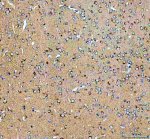 AP2A1 Antibody Rat Brain IHC. Immunohistochemistry staining of FFPE rat brain tissue with AP2A1 Antibody at 2 ug/ml. HIER was performed using pH 8 EDTA buffer, followed by blocking with 10% goat serum. The tissue section was incubated with rabbit anti-AP2A1 antibody overnight at 4Â°C, followed by HRP-conjugated goat anti-rabbit IgG secondary antibody and DAB chromogen detection. AP2A1 Antibody / Clathrin Adaptor Protein Antibody, validated using AP2A1 knockout cells, demonstrates neuronal staining consistent with AP-2 adaptor complex expression and supports studies of clathrin-mediated endocytosis, vesicle trafficking and neuronal membrane trafficking pathways.