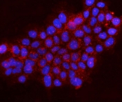 Gephyrin Antibody A431 IF. Immunofluorescence analysis of FFPE human A431 cells using Gephyrin antibody (red) shows punctate cytoplasmic staining consistent with Gephyrin localization in receptor clustering and inhibitory synaptic scaffold-associated structures, while nuclei are counterstained with DAPI (blue). HIER: steam sections in pH6 citrate buffer for 20 min.
