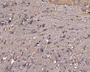 Gephyrin Antibody Rat Brain IHC. Immunohistochemistry of FFPE rat brain tissue using Gephyrin antibody demonstrates punctate HRP-DAB brown cytoplasmic staining in neuronal cells, consistent with Gephyrin-associated inhibitory synapse organization and receptor scaffold localization in brain tissue. HIER: boil tissue sections in pH8 EDTA for 20 min and allow to cool before testing.