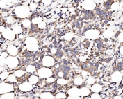 IHC staining of FFPE human breast tissue with FKBP15 antibody. HIER: boil tissue sections in pH8 EDTA for 20 min and allow to cool before testing.