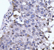 IHC staining of FFPE human liver tissue with NUP210 antibody. HIER: boil tissue sections in pH8 EDTA for 20 min and allow to cool before testing.