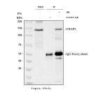 UBAP2 Antibody Human HeLa IP-WB. Immunoprecipitation of endogenous UBAP2 from human HeLa cell lysate using UBAP2 Antibody, followed by Western blot detection with the same antibody. Lane 1: input HeLa lysate, lane 2: rabbit IgG immunoprecipitation control and lane 3: UBAP2 immunoprecipitation. A specific band is detected at approximately 140 kDa in the input and UBAP2 immunoprecipitate, while absent from the IgG control, demonstrating specific enrichment of endogenous UBAP2. These results support the use of UBAP2 Antibody, also called Ubiquitin-Associated Protein 2 Antibody, for immunoprecipitation and studies of ubiquitin-associated protein function, intracellular protein trafficking and cellular homeostasis.