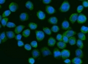 ZC3H7A Antibody SiHa IF. Immunofluorescence analysis of FFPE human SiHa cells using ZC3H7A Antibody / Zinc Finger CCCH-Type Containing 7A Antibody demonstrates diffuse green fluorescence distributed throughout the cytoplasm and extending into the perinuclear region, consistent with the reported localization of Zinc finger CCCH-type containing 7A (ZC3H7A), an RNA-binding protein involved in RNA metabolism and post-transcriptional regulation of gene expression. The staining pattern supports the association of ZC3H7A with intracellular RNA regulatory pathways and ribonucleoprotein complexes that govern transcript processing and cellular gene expression. Nuclei are visualized with DAPI nuclear stain (blue). HIER: steam tissue sections in pH6 citrate buffer for 20 minutes prior to staining. ZC3H7A antibody is shown in green and DAPI is shown in blue.