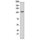 ZC3H7A Antibody K562 WB. Western blot analysis of human K562 cell lysate using ZC3H7A Antibody / Zinc Finger CCCH-Type Containing 7A Antibody detects a prominent band at approximately 110-115 kDa, consistent with the predicted molecular weight of Zinc finger CCCH-type containing 7A (ZC3H7A). ZC3H7A is a CCCH-type zinc finger RNA-binding protein that participates in RNA metabolism, messenger RNA processing, and post-transcriptional regulation of gene expression through interactions with RNA-containing protein complexes. The observed band is consistent with expression of full-length ZC3H7A in human K562 cells and supports the use of this antibody for studies of RNA-binding protein biology, transcript regulation, and cellular gene expression pathways. Predicted molecular weight: approximately 111 kDa.