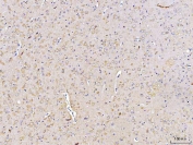 DUSP6 Antibody Rat Brain IHC. Immunohistochemical staining of FFPE rat brain tissue using DUSP6 antibody demonstrates diffuse cytoplasmic HRP-DAB brown staining throughout neuronal-rich regions of the brain. The staining pattern is consistent with expression of DUSP6, a dual-specificity phosphatase that functions as a key negative regulator of ERK/MAPK signaling pathways. By dephosphorylating activated ERK proteins, DUSP6 helps control signaling intensity and duration, thereby regulating cellular responses associated with differentiation, survival, and tissue homeostasis. The observed neural expression pattern is consistent with the importance of tightly regulated MAPK signaling in nervous system function and cellular communication. HIER: boil tissue sections in pH 8 EDTA for 20 minutes and allow to cool before testing.