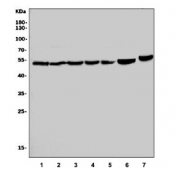 DUSP6 Antibody Multi-Species Western Blot. Western blot analysis of human U-87 MG (lane 1), RT4 (lane 2), PC-3 (lane 3), HL-60 (lane 4), HepG2 (lane 5), rat brain (lane 6), and mouse brain (lane 7) lysates using DUSP6 antibody demonstrates prominent bands migrating at approximately 50-60 kDa across all tested samples. DUSP6 (Dual Specificity Phosphatase 6) is a key negative regulator of ERK/MAPK signaling pathways, functioning to dephosphorylate activated ERK proteins and thereby modulate signal transduction, cellular differentiation, proliferation, and growth factor responses. Detection of DUSP6 in multiple human cell lines and rodent brain tissues supports its broad role in maintaining MAPK signaling homeostasis across diverse tissue types and biologic systems. Predicted molecular weights are approximately 42 kDa and 26 kDa for DUSP6 isoforms 1 and 2, respectively.