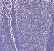IHC staining of FFPE human tonsil tissue with CD2 antibody, HRP-secondary and DAB substrate. HIER: boil tissue sections in pH8 EDTA for 20 min and allow to cool before testing.