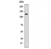 P-Cadherin Antibody A431 Cell WB. Western blot analysis of human A431 cell lysate using P-Cadherin Antibody / Epithelial Cell Adhesion Antibody. A specific band is detected between approximately 100â130 kDa, consistent with the expected migration range of glycosylated P-Cadherin. The unmodified protein has a predicted molecular weight of approximately 91 kDa. This result supports the use of P-Cadherin Antibody / Epithelial Cell Adhesion Antibody for analyzing epithelial adhesion protein expression and cadherin family signaling pathways in human cancer cell models.