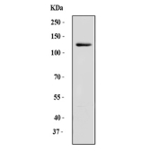 P-Cadherin Antibody Human A431 Cell WB. Western blot analysis of human A431 cell lysate using P-Cadherin Antibody / Epithelial Cell Adhesion Antibody. A specific band is observed between approximately 100â130 kDa, consistent with the expected molecular weight range of glycosylated P-Cadherin. The unmodified CDH3 protein has a predicted molecular weight of approximately 91 kDa. These results support the use of P-Cadherin Antibody / Epithelial Cell Adhesion Antibody for studying epithelial cell adhesion proteins, cadherin expression and cell junction regulation.