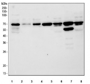CDT1 Antibody Human, Rat and Mouse WB. Western blot analysis of human HepG2, HeLa, and 293T cell lysates together with rat liver, rat brain, mouse liver, and mouse brain tissue lysates using CDT1 antibody demonstrates detection of a prominent band at approximately 60-70 kDa, consistent with the expected molecular weight of Chromatin Licensing and DNA Replication Factor 1 (CDT1). CDT1 is a DNA replication licensing factor that plays an essential role in pre-replication complex assembly and regulation of genome duplication during cell cycle progression. The observed expression across multiple human, rat, and mouse samples supports the utility of this antibody for studies of DNA replication licensing, cellular proliferation, cell cycle control, and genome stability mechanisms. Predicted molecular weight: ~60 kDa, commonly observed at 60-70 kDa.