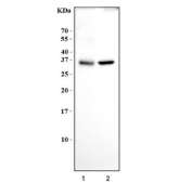 NGFB Antibody Cell Lysate WB. Western blot analysis of human U-87 MG and PC-3 cell lysates using NGFB Antibody / Neurotrophin Survival Factor Antibody. Lane 1: U-87 MG cell lysate, Lane 2: PC-3 cell lysate. Prominent bands are detected near 30-35 kDa, slightly above the predicted molecular weight of mature NGFB / Nerve growth factor beta dimer-associated forms at approximately 27 kDa. The observed migration pattern is consistent with processed neurotrophin expression and may reflect differential post-translational modification or precursor-associated NGF species in human tumor cell lines.