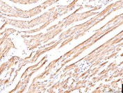 IHC staining of FFPE rat heart tissue with PLB antibody, HRP-secondary and DAB substrate. HIER: boil tissue sections in pH8 EDTA for 20 min and allow to cool before testing.