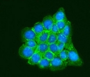 RPLP0 Antibody IF. Immunofluorescent staining of FFPE human A431 cells using RPLP0 Antibody / Ribosomal Protein P0 Antibody demonstrates strong cytoplasmic and perinuclear green fluorescence consistent with the intracellular localization of RPLP0. As a core component of the 60S ribosomal subunit and ribosomal stalk complex, RPLP0 plays an essential role in protein synthesis by facilitating interactions between the ribosome and translation factors required for efficient mRNA translation. The observed staining pattern is consistent with the widespread cytoplasmic distribution expected for a ribosomal protein involved in cellular protein production and translational regulation. Nuclei are counterstained with DAPI (blue). HIER was performed by steaming sections in pH 6 citrate buffer for 20 minutes prior to staining. Green = RPLP0 antibody; Blue = DAPI nuclear stain.