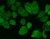 WNT8B Antibody MCF7 IF. Immunofluorescent staining of FFPE human MCF7 cells using WNT8B antibody demonstrates prominent cytoplasmic and membranous green fluorescence, consistent with expression of WNT8B, a secreted Wnt family signaling ligand involved in developmental and cellular communication pathways. WNT8B functions upstream of Wnt signaling cascades that regulate cell fate determination, differentiation, tissue patterning, and signal transduction. The observed staining pattern is consistent with the synthesis and secretion of Wnt ligands and supports the utility of WNT8B antibody for studies of developmental signaling, cellular communication, and Wnt pathway biology. HIER: steam section in pH6 citrate buffer for 20 min.