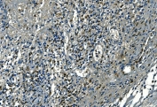 IHC staining of FFPE human appendicitis tissue with Azurocidin antibody. HIER: boil tissue sections in pH8 EDTA for 20 min and allow to cool before testing.