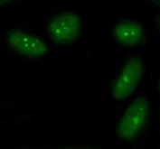 Immunofluorescence analysis of BAP1 expression in U87 cells. Human U87 cells were stained with anti-BRCA1-Associated Protein 1 antibody (green), followed by Fluoro488-conjugated goat anti-rabbit IgG secondary antibody. BAP1 signal is observed predominantly within the nuclear region, appearing as punctate and diffuse nuclear staining patterns consistent with chromatin-associated localization. This distribution aligns with the known role of BRCA1-associated protein 1 as a nuclear deubiquitinating enzyme involved in chromatin regulation and transcriptional control.