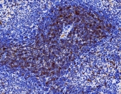 CD27 Antibody Rat Spleen IHC. Immunohistochemistry analysis of CD27 / TNFRSF7 expression in FFPE rat spleen tissue using CD27 Immunohistochemistry Antibody. Strong membranous and cytoplasmic HRP-DAB brown staining is observed in lymphocyte populations within splenic white pulp regions, consistent with CD27 expression on T cells and memory B cells, while surrounding non-lymphoid areas show minimal staining. The staining highlights lymphoid architecture and immune cell localization in spleen tissue. Heat-induced epitope retrieval was performed in pH 8 EDTA buffer for 20 minutes followed by cooling prior to antibody incubation.