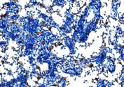 CD27 Antibody Mouse Lymph Node IHC. Immunohistochemistry analysis of CD27 / TNFRSF7 expression in FFPE mouse lymph node tissue using CD27 Immunohistochemistry Antibody. Membranous and cytoplasmic HRP-DAB brown staining is observed in scattered lymphocyte populations within lymph node parenchyma, consistent with CD27 expression on activated and memory T and B cells, while adjacent non-lymphoid structures remain largely unstained. The distribution of positive cells supports identification of immune cell subsets within the lymph node microenvironment. Heat-induced epitope retrieval was performed in pH 8 EDTA buffer for 20 minutes followed by cooling prior to antibody incubation.