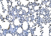 Dectin 1 Antibody Mouse Lung IHC. Immunohistochemistry of FFPE mouse lung tissue using Dectin 1 antibody shows membranous and cytoplasmic HRP-DAB brown staining in scattered immune-associated cells within pulmonary tissue, consistent with Dectin-1 / CLEC7A expression in myeloid populations involved in innate immune surveillance and fungal recognition. HIER: boil tissue sections in pH8 EDTA for 20 min and allow to cool before testing.