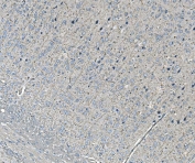 NEDD4 Antibody Rat Brain IHC Neuronal Cytoplasmic Staining. Immunohistochemistry analysis of Neural precursor cell expressed developmentally down-regulated protein 4 / NEDD4 in FFPE rat brain tissue using NEDD4 Antibody for IHC. HRP-DAB brown chromogenic staining demonstrates cytoplasmic localization in neuronal cell bodies distributed throughout the tissue, with lighter background signal in surrounding neuropil and minimal staining in non-neuronal regions. The staining pattern supports neuronal expression of NEDD4 within brain tissue architecture. HIER: boil tissue sections in pH8 EDTA for 20 min and allow to cool before testing.