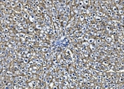 Egf receptor Antibody Rat Liver IHC. Immunohistochemistry staining of FFPE rat liver with Egf receptor antibody. HIER: boil tissue sections in pH8 EDTA for 20 min and allow to cool before testing.
