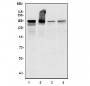 Egf receptor Antibody Mouse/Rat Liver, Lung, Spleen WB. Western blot testing of 1) rat liver, 2) mouse liver, 3) mouse spleen and 4) mouse lung tissue lysate with Egf receptor antibody. Expected molecular weight: 134-180 kDa depending on glycosylation level.