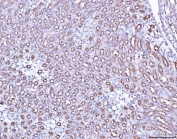 ACP3 Antibody Mouse Kidney IHC. Immunohistochemistry staining of FFPE mouse kidney tissue with ACP3 antibody. HIER: boil tissue sections in pH8 EDTA for 20 min and allow to cool before testing.