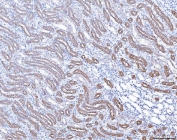 ACP3 Antibody Rat Kidney IHC. Immunohistochemistry staining of FFPE rat kidney tissue with ACP3 antibody. HIER: boil tissue sections in pH8 EDTA for 20 min and allow to cool before testing.