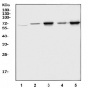 ALAS2 Antibody Multi-Species WB. Western blot analysis of human 293T (lane 1), rat liver (lane 2), rat heart (lane 3), mouse liver (lane 4), and mouse heart (lane 5) lysates using ALAS2 Antibody / Erythroid Heme Biosynthesis Enzyme Antibody demonstrates a prominent immunoreactive band at approximately 65-72 kDa. ALAS2 is a mitochondrial enzyme that catalyzes the first and rate-limiting step of heme biosynthesis, initiating production of 5-aminolevulinic acid required for heme and hemoglobin synthesis. The observed banding pattern across human, rat, and mouse tissues supports cross-species recognition of ALAS2 and is consistent with expression of this highly conserved heme biosynthetic enzyme. The detected molecular weight is in agreement with the expected migration of ALAS2, which is commonly observed at approximately 65-72 kDa depending on species, processing state, and electrophoretic conditions. Predicted molecular weight: approximately 65 kDa. Observed molecular weight: approximately 65-72 kDa.