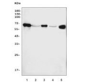 Western blot testing of human 1) placenta, 2) HepG2, 3) A431, 4) HeLa and 5) SW620 cell lysate with Placental Alkaline Phosphatase antibody 6C7G3. Predicted molecular weight ~58 kDa but routinely visualized at 60-70 kDa.